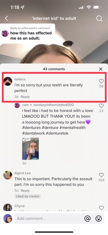 Section de commentaires TikTok montrant un commentaire en surbrillance, qui se lit "Je suis vraiment désolé mais tes dents sont littéralement parfaites."