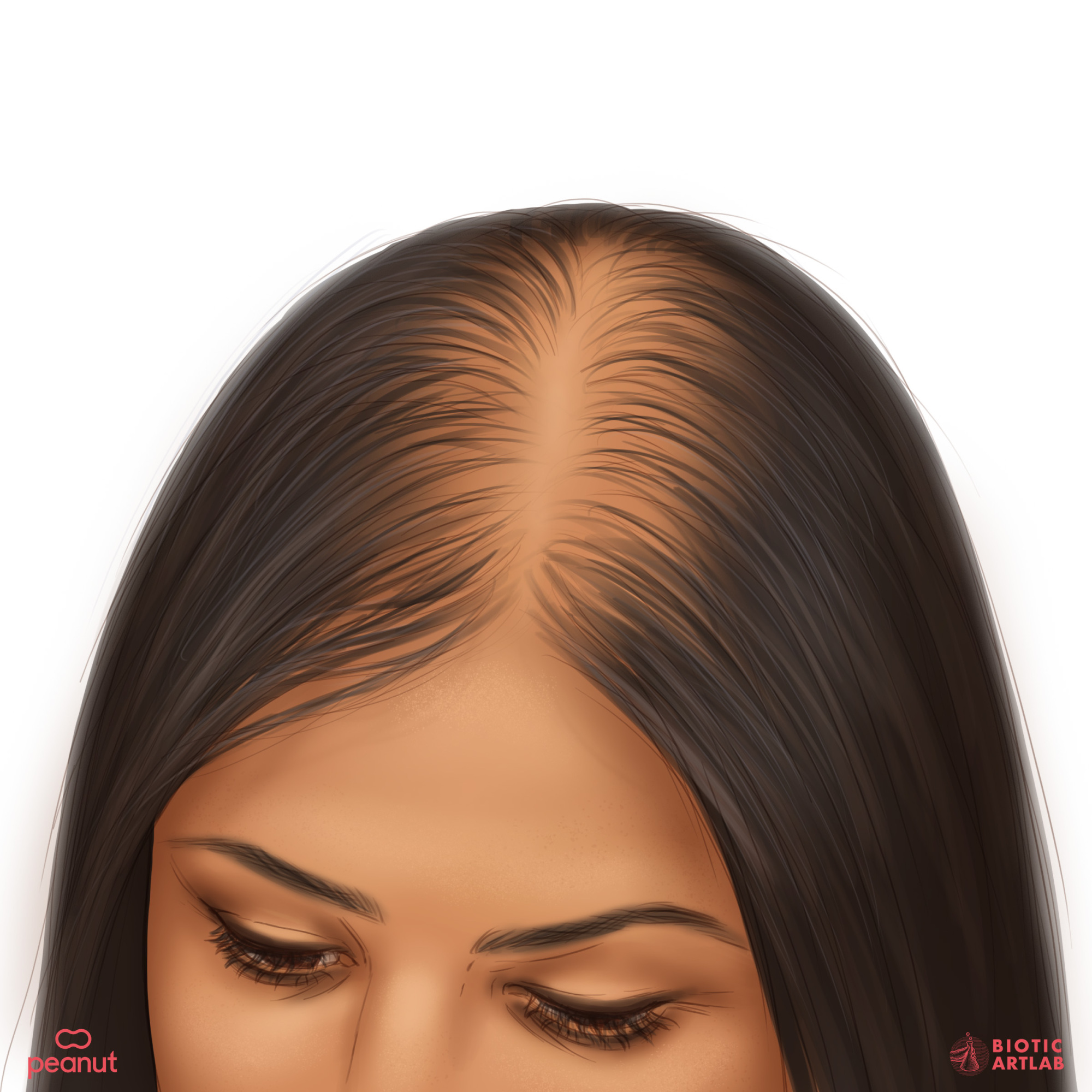 Image d'une femme souffrant de perte de cheveux, avec le haut de sa tête montrant des cheveux clairsemés.