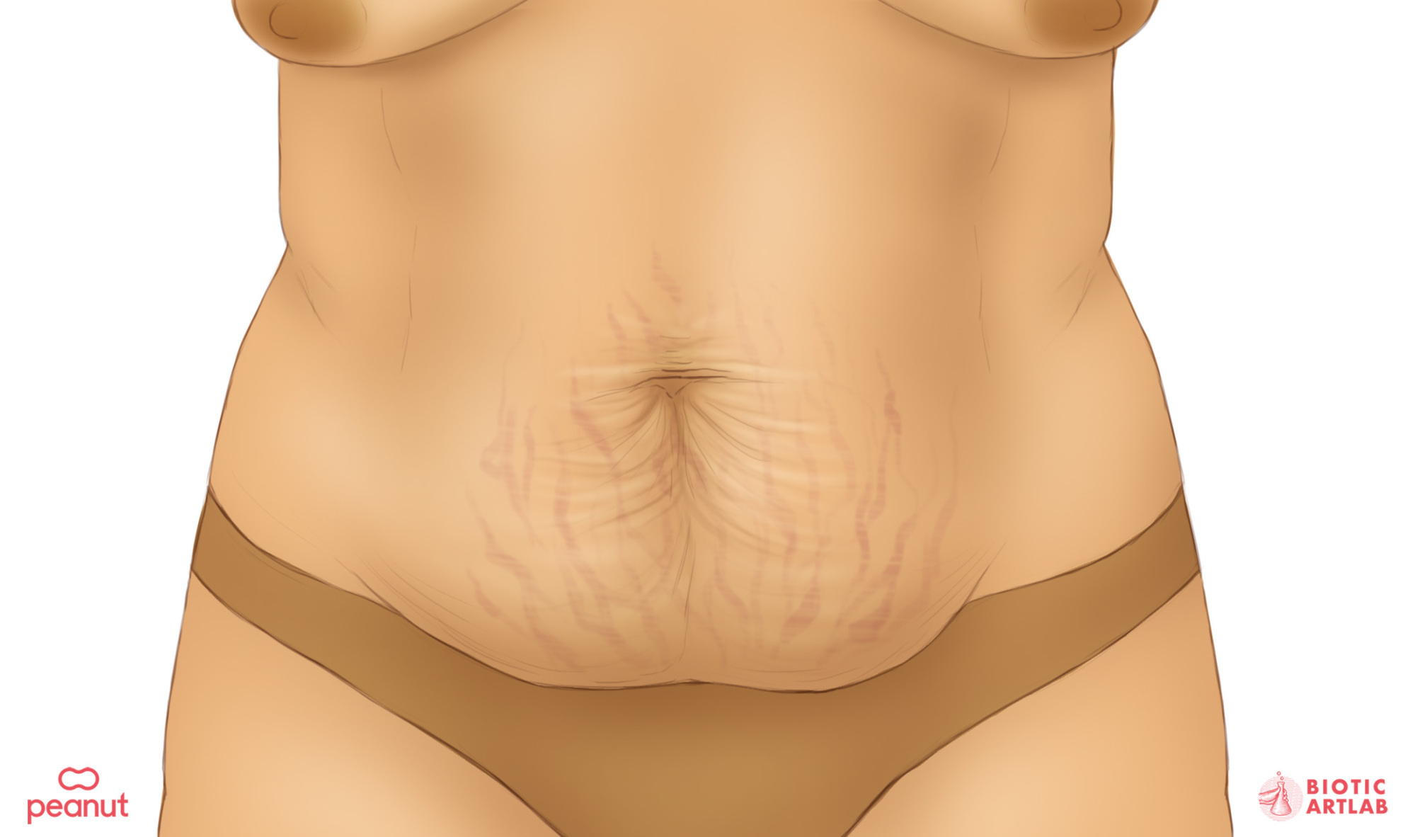 Une illustration du corps d'une femme après la grossesse.