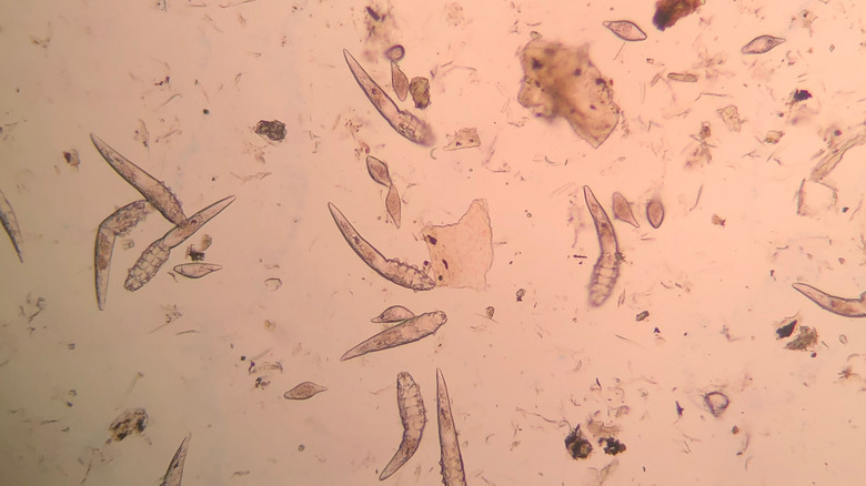 Les acariens Demodex sont vus au microscope