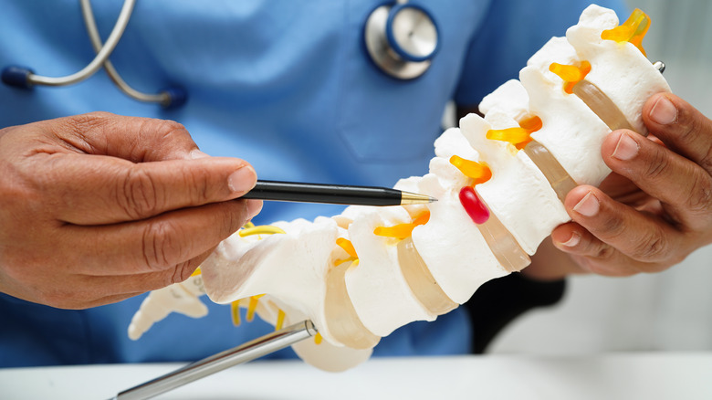 Un médecin détient un modèle de la colonne vertébrale inférieure, y compris le coccyx