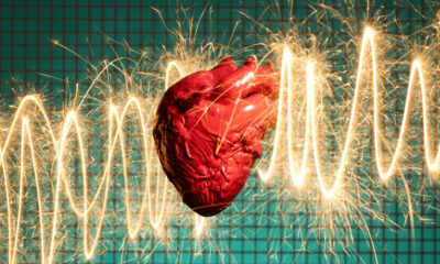 Si vous avez l’un de ces groupes sanguins, vous pourriez courir un plus grand risque de crise cardiaque