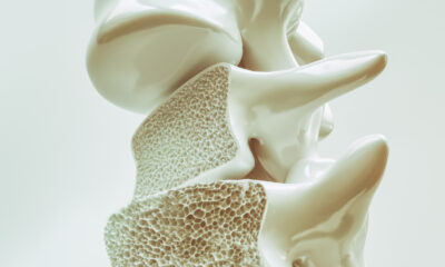 L’immense découverte scientifique qui pourrait un jour inverser l’ostéoporose