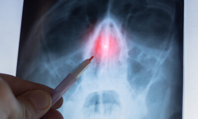 Les scientifiques débattent encore de la fonction de cet organe « inutile » chez l’homme