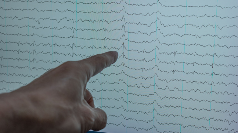 Une main pointant vers un graphique EEG sur un écran.