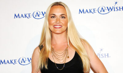 La transformation du visage de Vanessa Trump est incroyable à voir sur les photos côte à côte