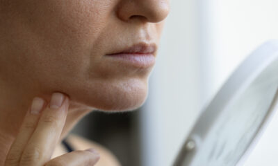 Le phénomène du « visage ozempic » s’explique facilement par la science