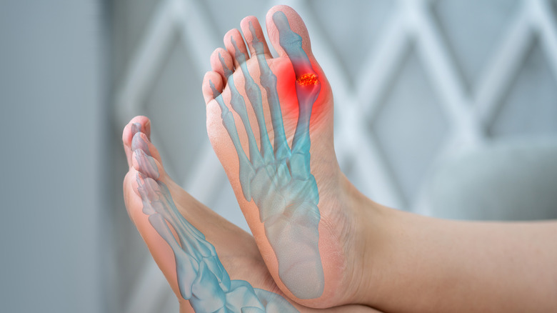 Bas du pied avec un visuel bleu ressemblant à une radiographie du squelette et un point rouge de douleur sur le ballon