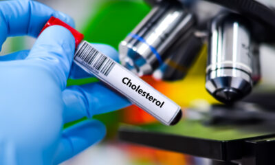 Ce que les scientifiques savent sur le cholestérol que vous ignoriez (jusqu'à présent)