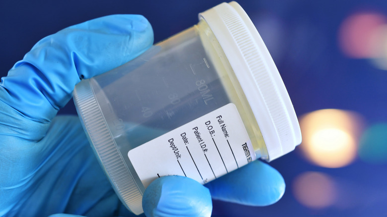 Une main gantée tenant un gobelet à spécimen en plastique