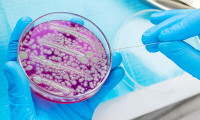 Des scientifiques révèlent quelles bactéries vivent réellement dans votre nombril