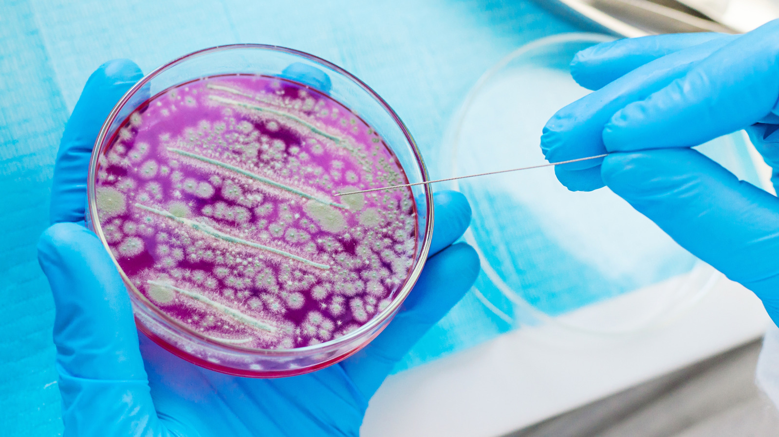 Des scientifiques révèlent quelles bactéries vivent réellement dans votre nombril