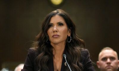 8 photos qui illustrent la transformation bouleversante des lèvres de Kristi Noem