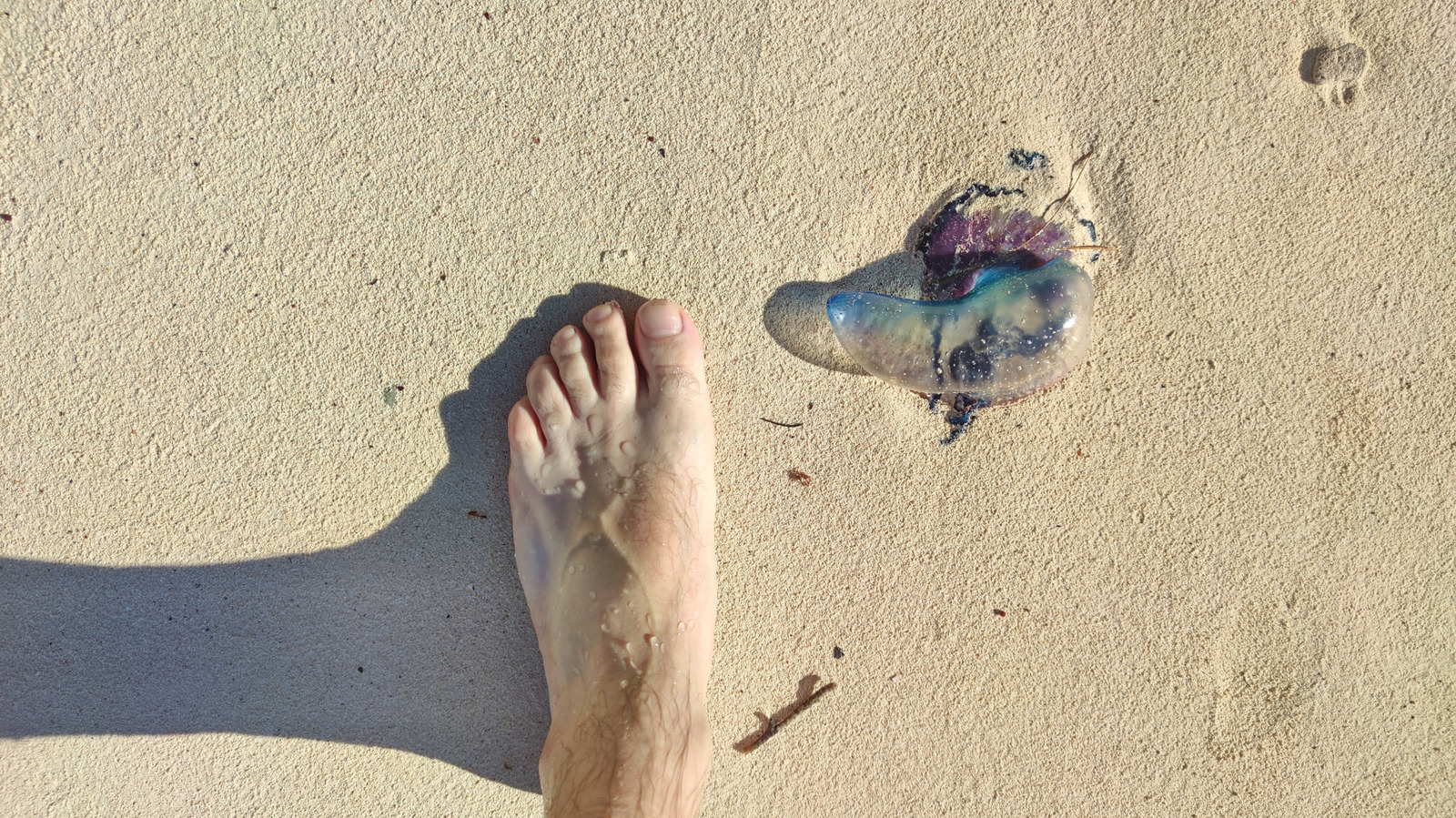 Que faire si vous vous faites piquer par une méduse à la plage
