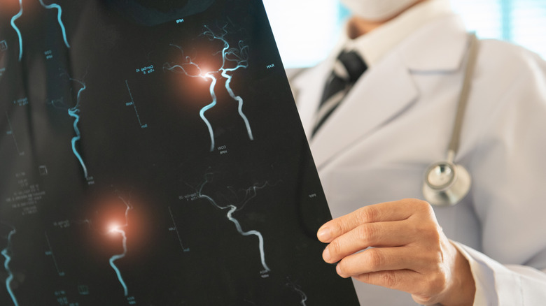 La main d'un médecin tenant un scanner cérébral avec des sections lumineuses de réseaux neuronaux