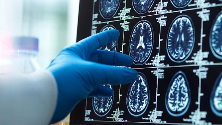 Une collection de scanners cérébraux examinés par une main gantée