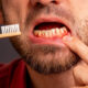 Des choses grossières qui arrivent lorsque vous arrêtez de vous brosser les dents pendant une semaine