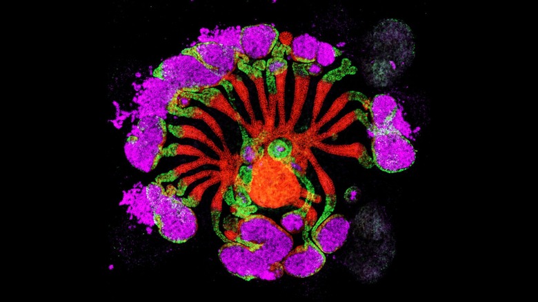 Organoïdes rénaux synthétiques humains (hSKO), cultivés en laboratoire, également connus sous le nom d'assembloïdes progéniteurs rénaux humains (hKPA), montrant la formation de néphrons radiaux connectés à un système collecteur central