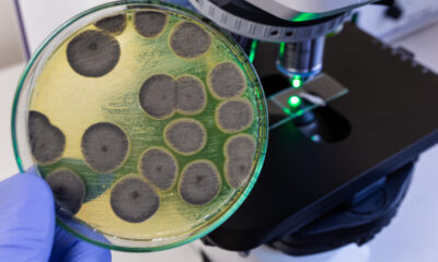 Les choses grossières que les spores de moisissures peuvent faire à votre corps