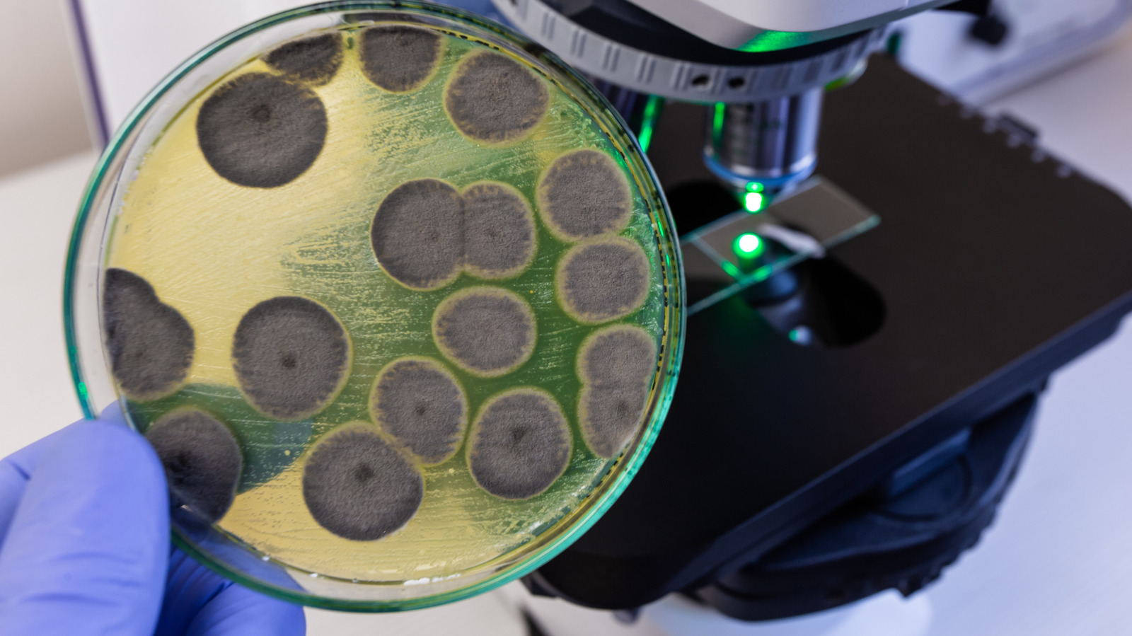 Les choses grossières que les spores de moisissures peuvent faire à votre corps