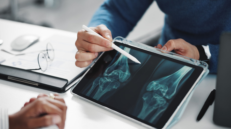 Médecin montrant des images d'os au patient sur une tablette