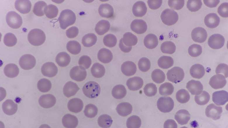 Plasmodium vivax au microscope.