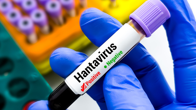Main gantée tenant un flacon de sang étiqueté pour le test du hantavirus
