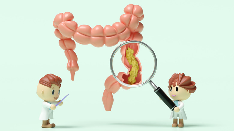 Concept de dessin animé de deux petits médecins, l'un tenant une loupe jusqu'à un modèle de côlon géant contenant des déchets