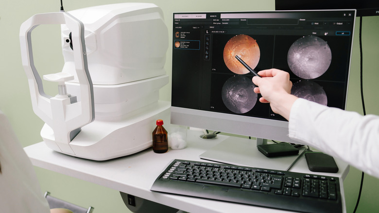 Médecin montrant les images de l'analyse rétinienne