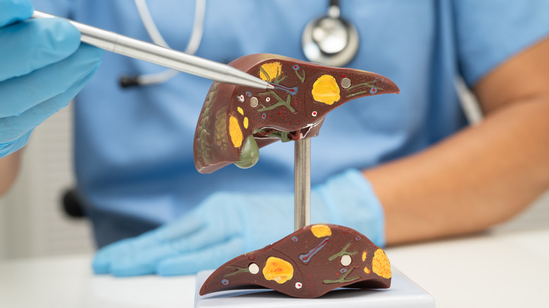 Professionnel de la santé montrant un modèle de foie