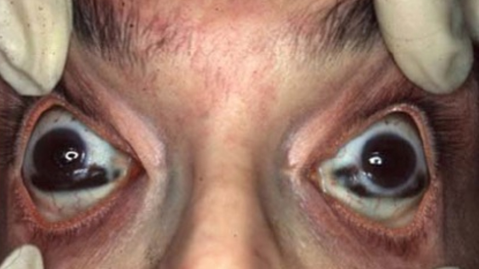 Le phénomène bizarre qui arrive aux yeux humains après la mort