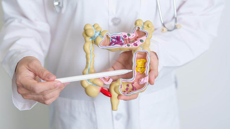 Médecin tenant un modèle intestinal et pointant vers le côlon