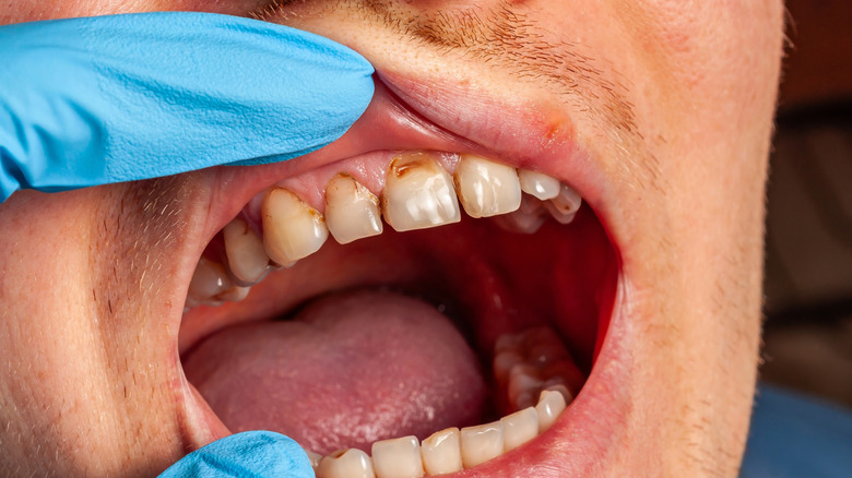 Personne ayant des dents examinées par un dentiste