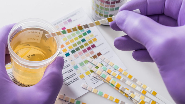 technicien de laboratoire testant un échantillon d'urine