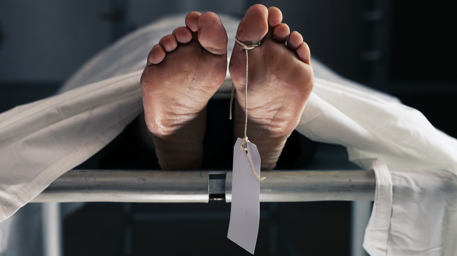 Le phénomène bizarre qui peut arriver à la peau humaine après la mort