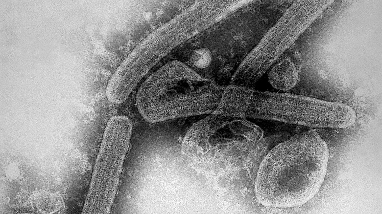 Micrographie électronique à transmission d'un virus de Marburg.