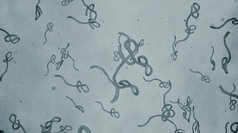 Le virus Ebola au microscope.