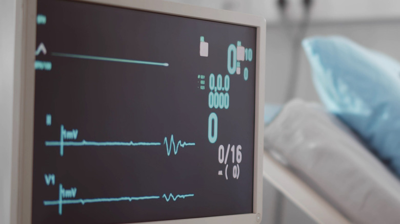 Un moniteur n'affichant aucune lecture vitale à côté d'un lit d'hôpital