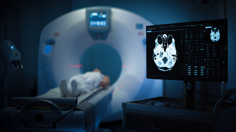 Une personne subissant une IRM cérébrale, avec une image de son cerveau apparaissant sur un écran d'ordinateur