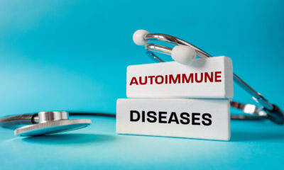 Les scientifiques ont peut-être trouvé un moyen d'expliquer pourquoi les femmes sont plus sensibles aux maladies auto-immunes